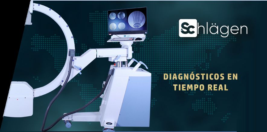 Arco en C para imágenes quirúrgicas en tiempo real