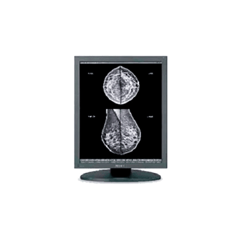 Monitor clínico para radiología