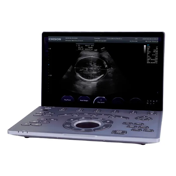 Ultrasonido Portátil SONOAIR-60 1 Vista general del ultrasonido portátil Sonoair-60 con diseño ligero y moderno