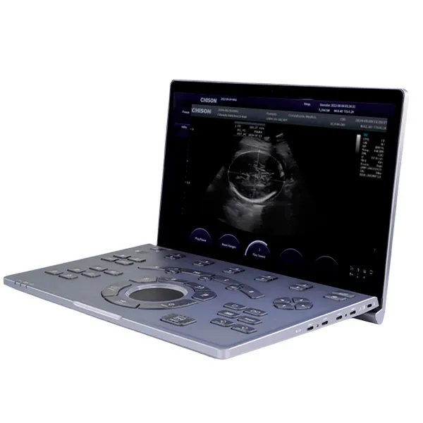 Ultrasonido Portátil SONOAIR-60 4 Ultrasonido portátil Sonoair-60 instalado en entorno hospitalario, listo para diagnóstico versátil