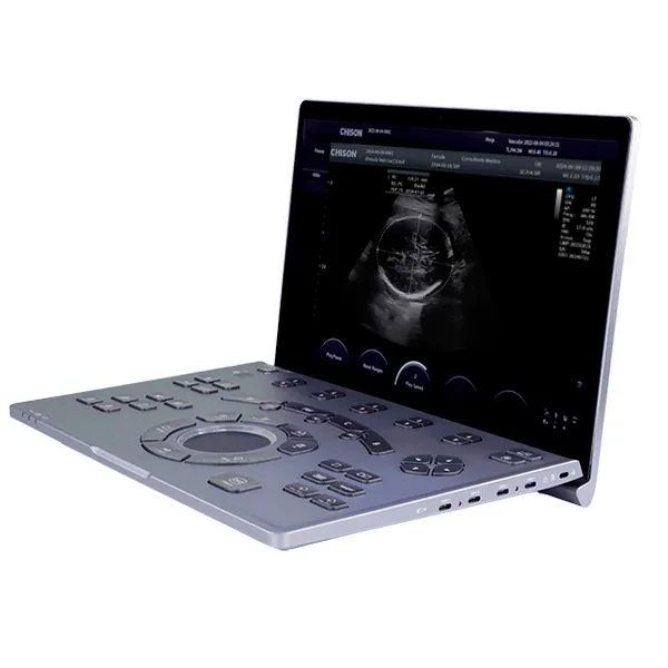 Ultrasonido Portátil SONOAIR-60 2 Pantalla del ultrasonido portátil Sonoair-60 con visualización de imágenes diagnósticas de alta resolución