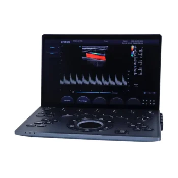 Ultrasonido Portátil Sonoair-30 listo para diagnóstico